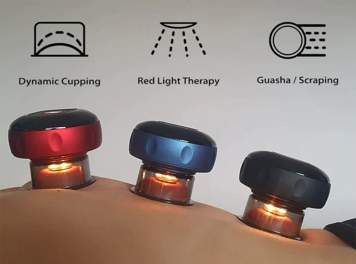 SmartCup cupping massager – photo 2 of 5